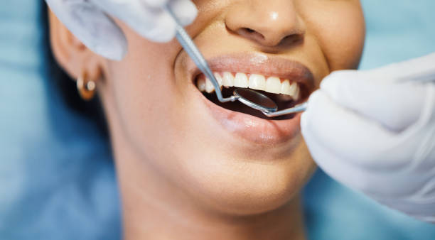 Best Emergency Broken Tooth Repair in Half Moon, NC