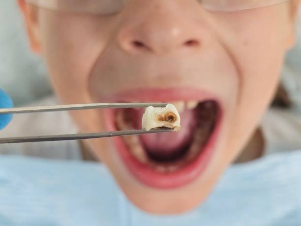 Best Pediatric Emergency Dentist in Half Moon, NC