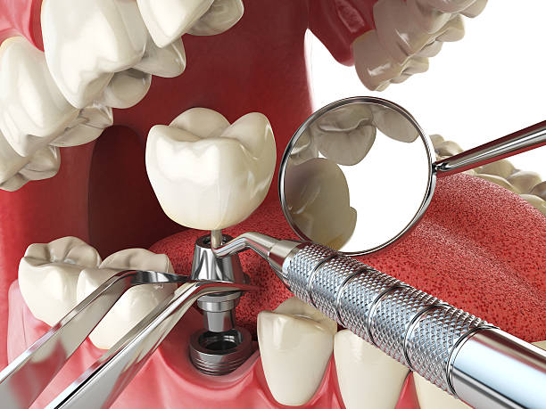Best Weekend Emergency Dentist in Half Moon, NC