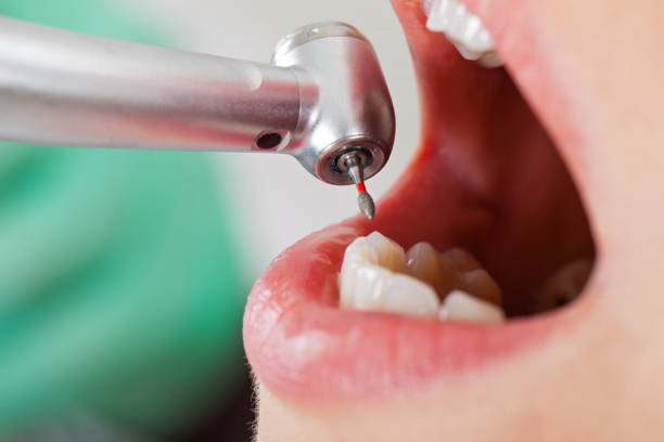 Best After-Hours Emergency Dentist in Half Moon, NC